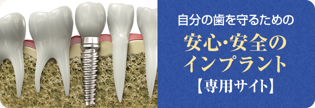 自分の歯を守るための安心・安全のインプラント【専用サイト】